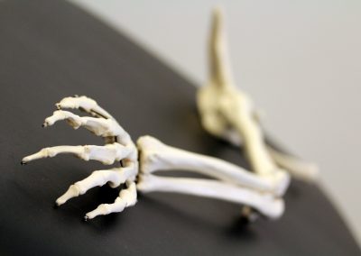 Arm FysioBoisot